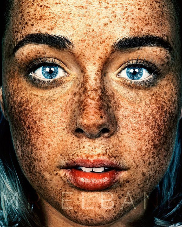 Beautiful Freckles