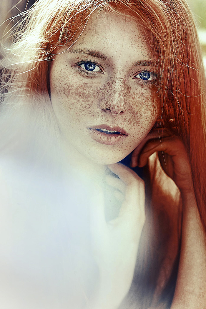 Beautiful Freckles