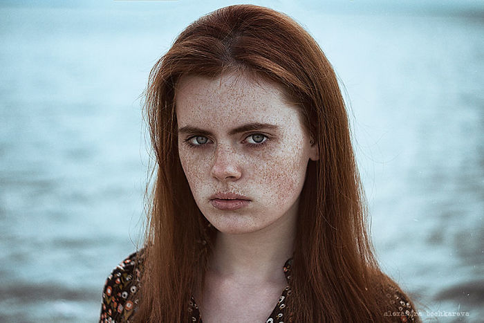 Beautiful Freckles