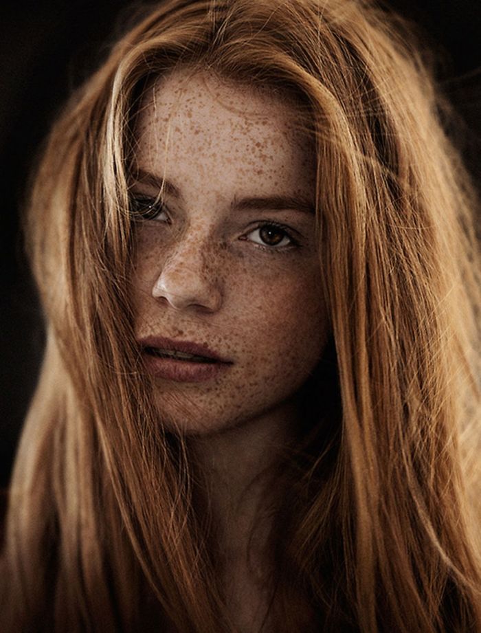 Beautiful Freckles