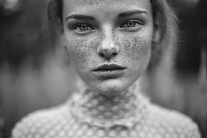 Beautiful Freckles