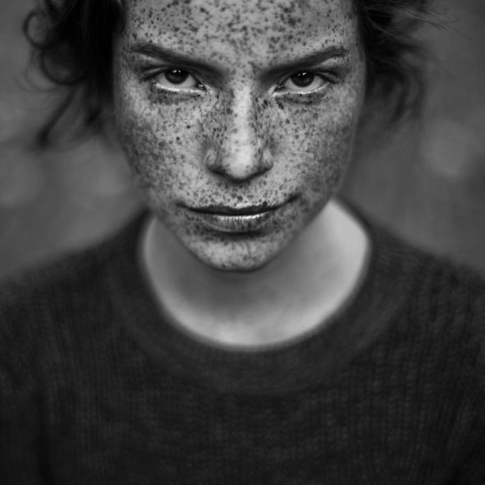 Beautiful Freckles