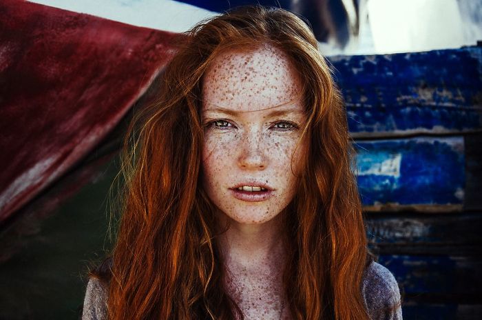 Beautiful Freckles