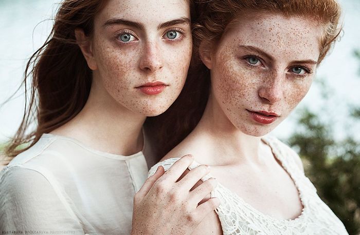 Beautiful Freckles