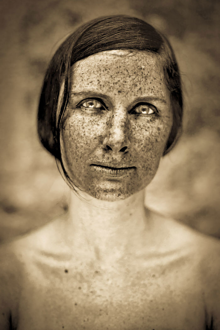 Beautiful Freckles