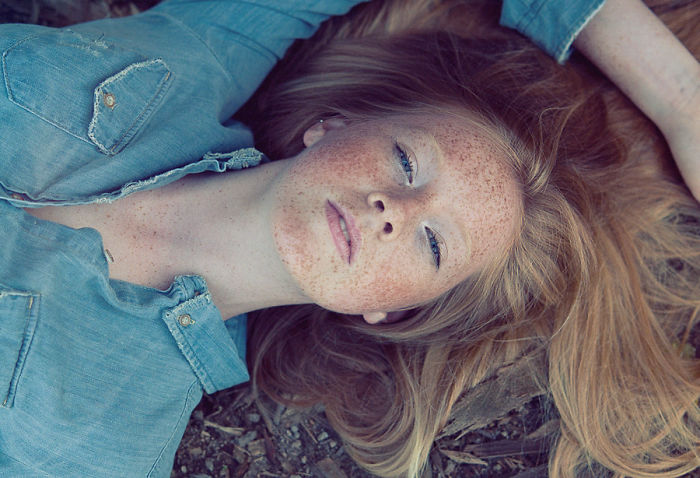 Beautiful Freckles