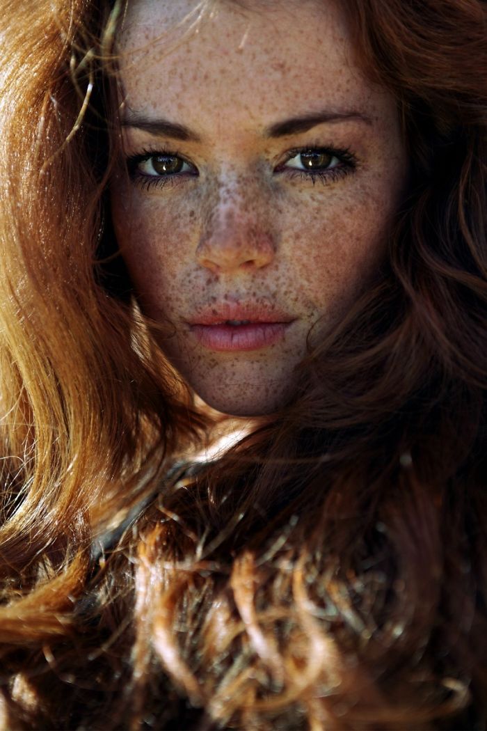 Beautiful Freckles
