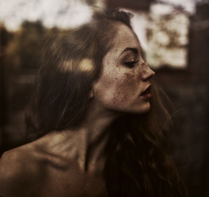 Beautiful Freckles