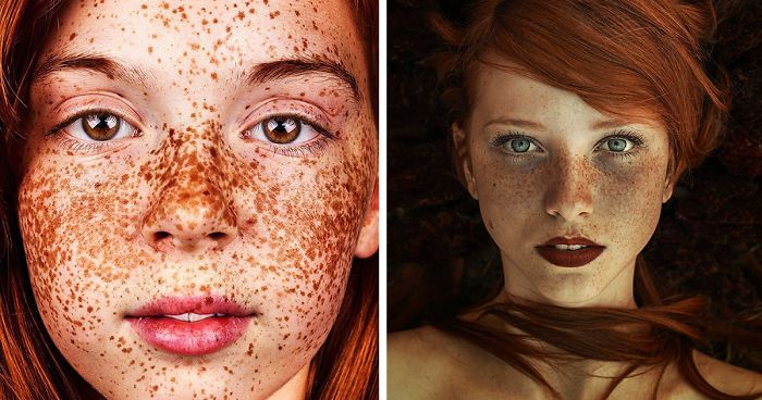 98 Freckled People Who’ll Hypnotize You With Their Unique Beauty