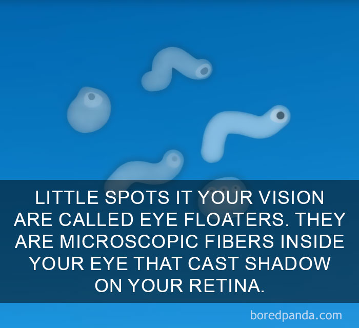 Illustration of eye floaters showing microscopic fibers casting shadows on the retina, amazing facts about vision explained.
