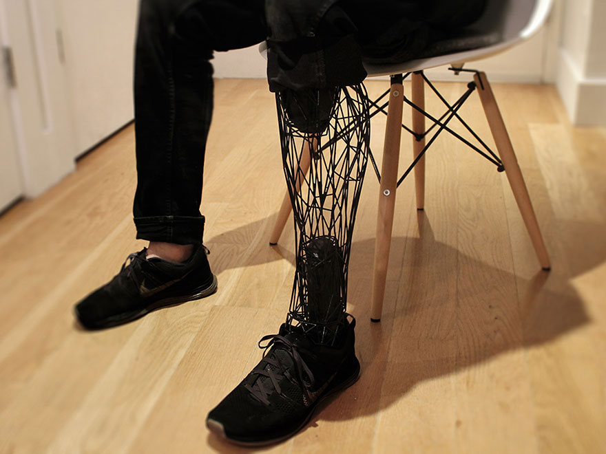 prosthetics-leg-3d-printed-titanium-william-root-4 prosthetics-leg-3d-printed-titanium-william-root-4