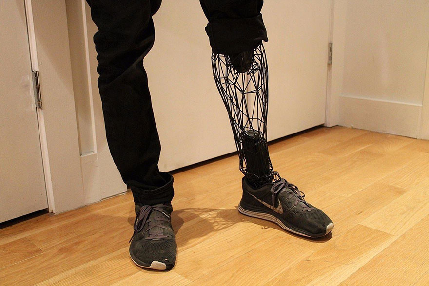 prosthetics-leg-3d-printed-titanium-william-root-8 prosthetics-leg-3d-printed-titanium-william-root-8