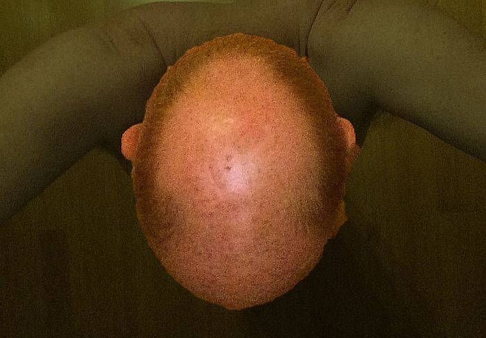 Supermoon Also Seen In Norway