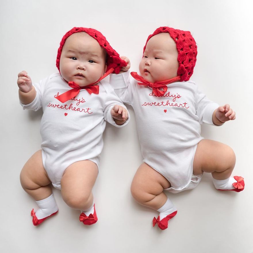 These Miracle Twins Have The Best Outfits Ever