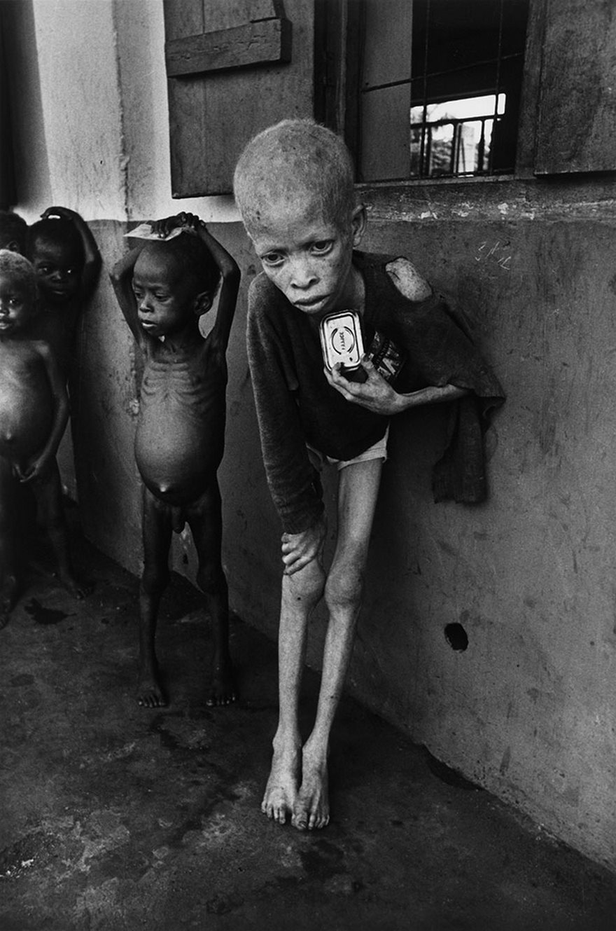 Malnourished children in a black and white historical photo, highlighting the impact of famine.