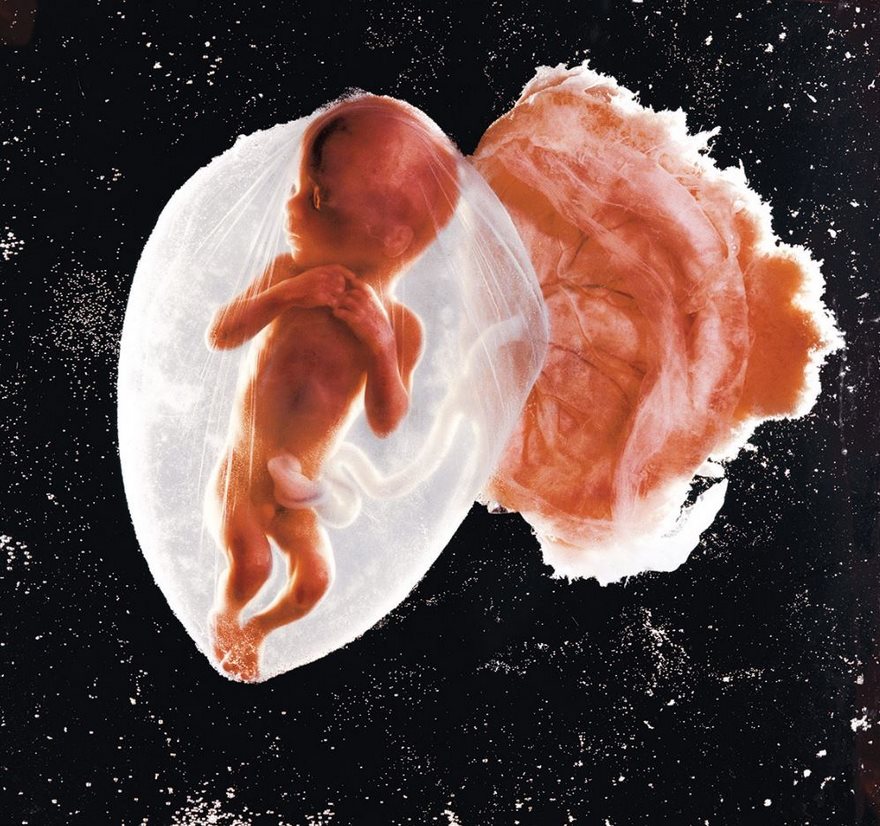 Famous photo of a human fetus inside the womb, showcasing early development stages against a black background.