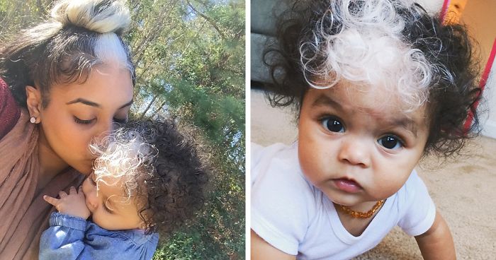 Little Girl Born With A White Patch Of Hair Which Is Exactly The Same As Her Mum’s