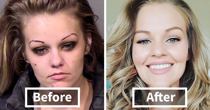 24 Stunning Before & After Transformations Of People Who Quit Drugs