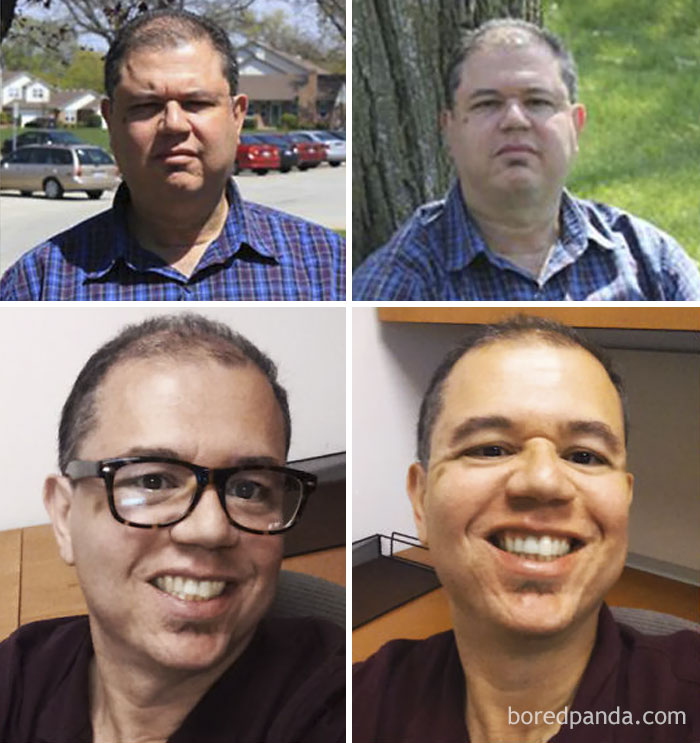 Lost 70 Lbs In Nine Months. I Can Smile Again