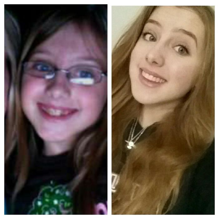 There Was A Lot Of Orthodontic Work Done