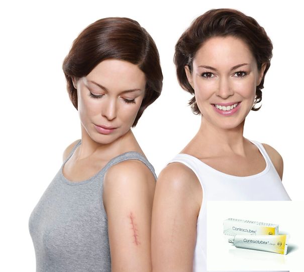 Healing Scars But On Different Hands, I Don't Get It