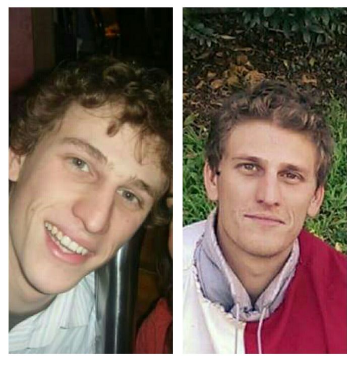 I Grew Into My Nose And Chin :)