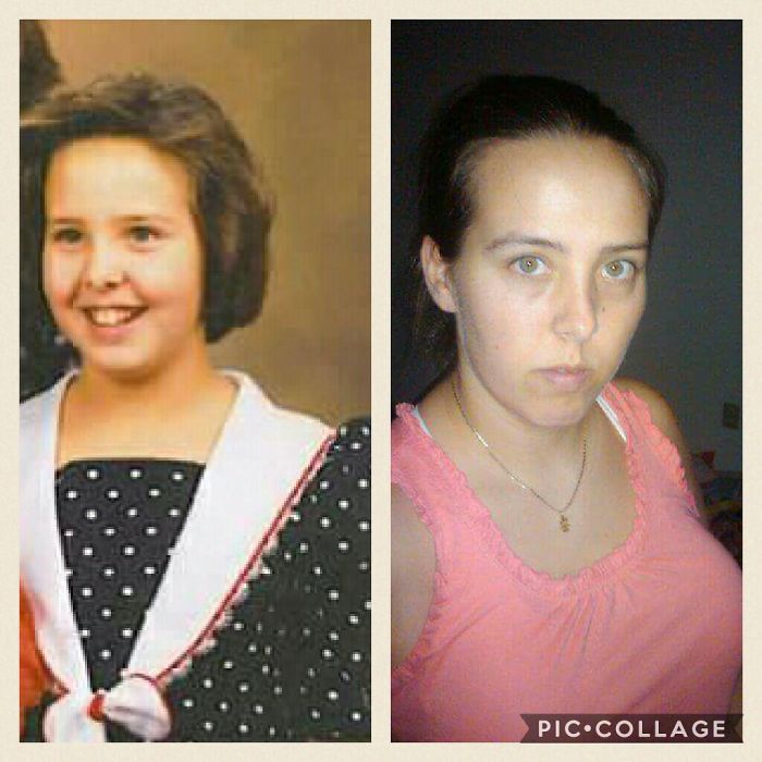 10 Years Old On Left And 28 Years Old On Right