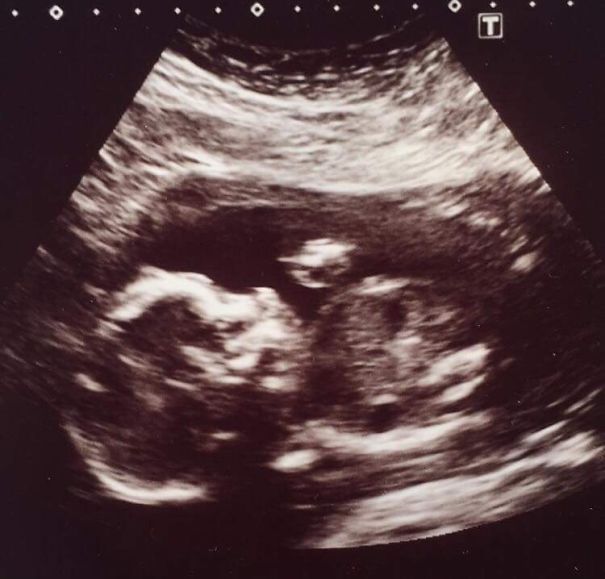 Bad Ass From The Start