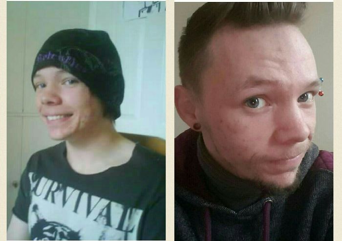 First Day Of College (17) Vs Now (24)