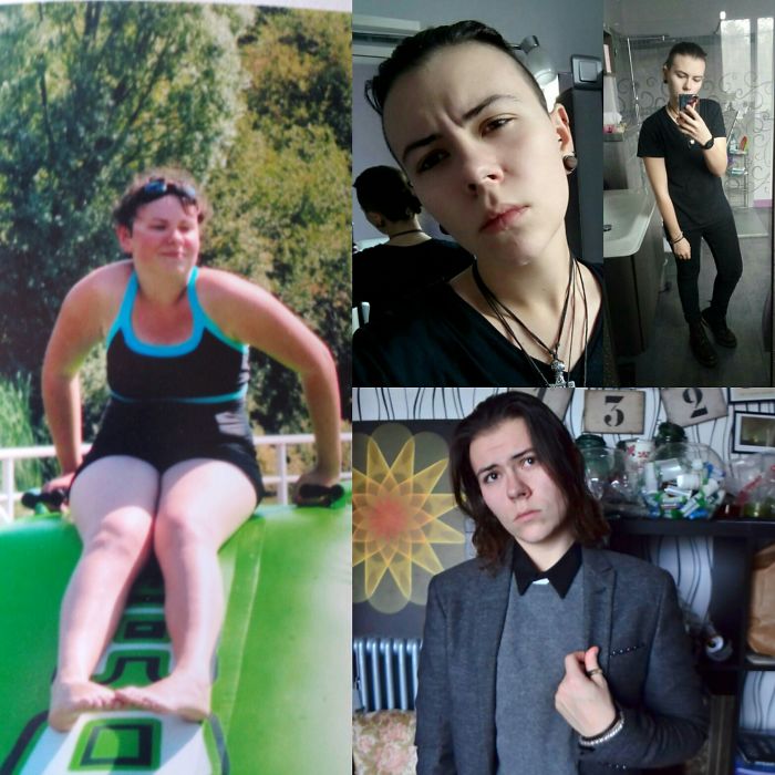 From An Overweighted Girl To An Handsome Transguy :)