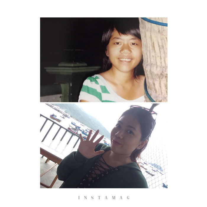 Seriously, I Did Have Rough Teen Years. Photos Of Me As 14 Yo And 24 Yo