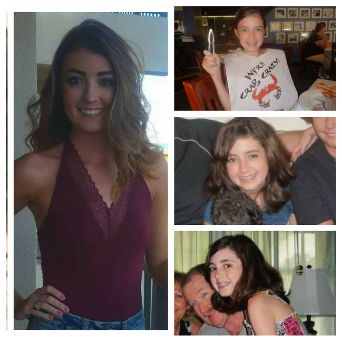 Skinny, Long Limbed Brace Face. I Didn't Gain Confidence Until After High School.