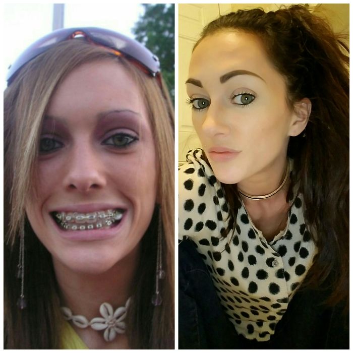 We Weren't All Gems In High School.