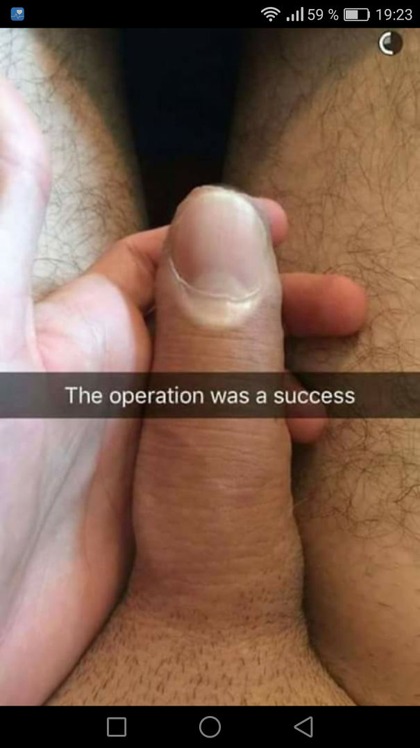 That Moment You Realize It Isn't Thumb... Awww...