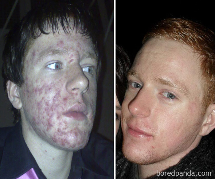 Me Age 15 And Me Age 21