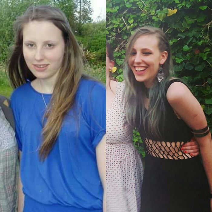 Me At 14 And Again At 20. I Think Its An Acheivment