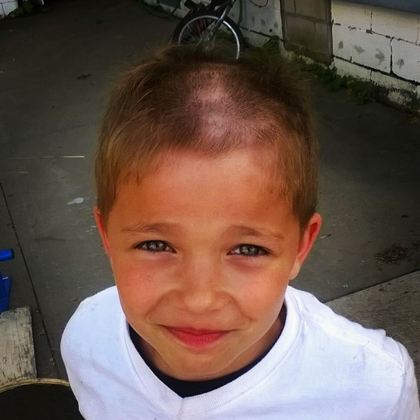 Child with a self-cut hairstyle, showing patches of missing hair on top, wearing a white shirt, smiling outdoors.