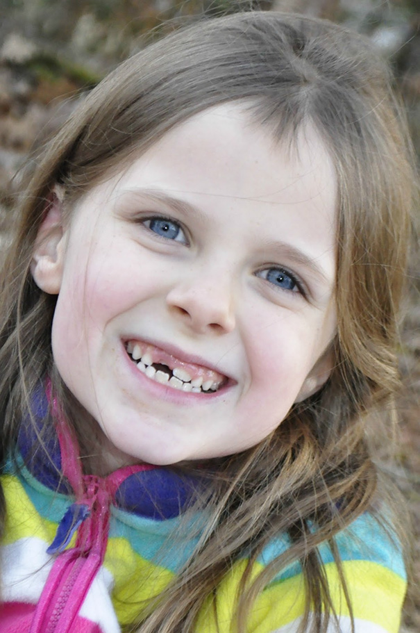Young child smiling, showing uneven teeth, with self-cut hair in a colorful jacket.