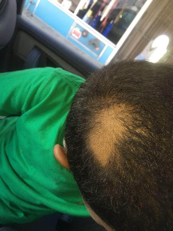 Child with a self-inflicted haircut featuring a large bald spot on top, wearing a green shirt.