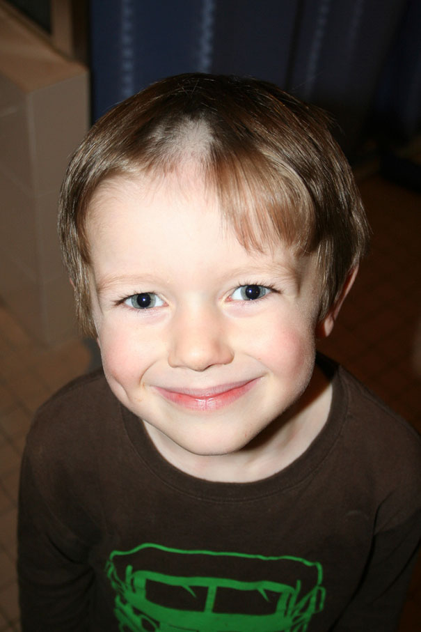 Child with a self-made haircut smiling, showing a patchy style.