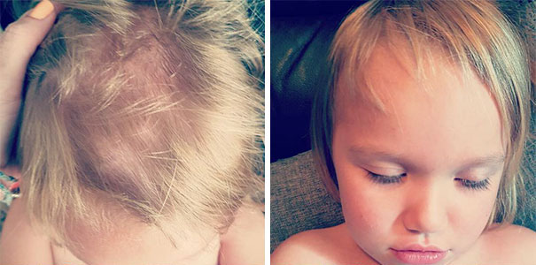 Child with self-cut hair; close-up of uneven haircut with visible scalp.