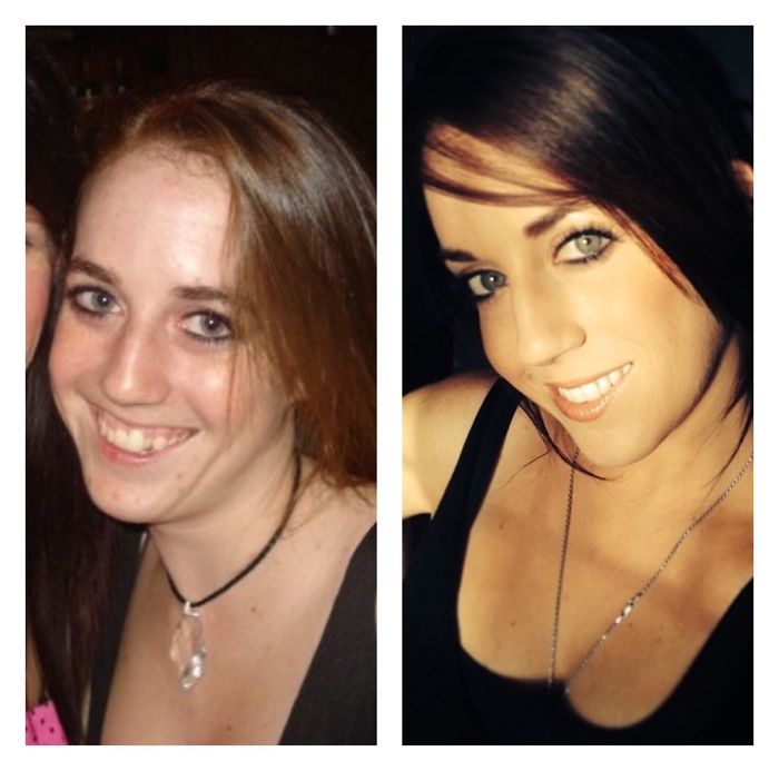 Thankfully I Grew Out Of My Awkward Teen Years!