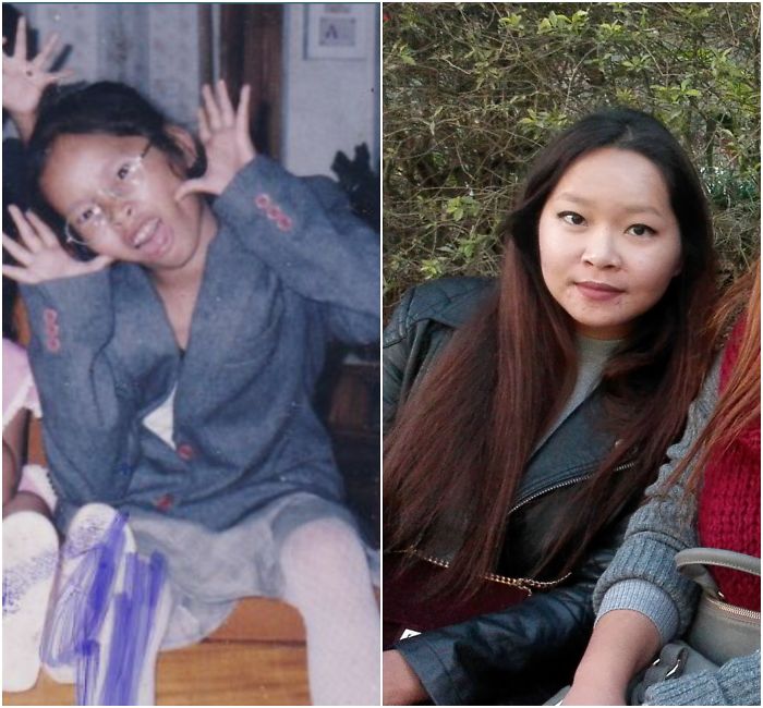 9-year-old Me And 27-year-old Me... Still Struggling With Adult Acne But Feeling Much Better About Myself