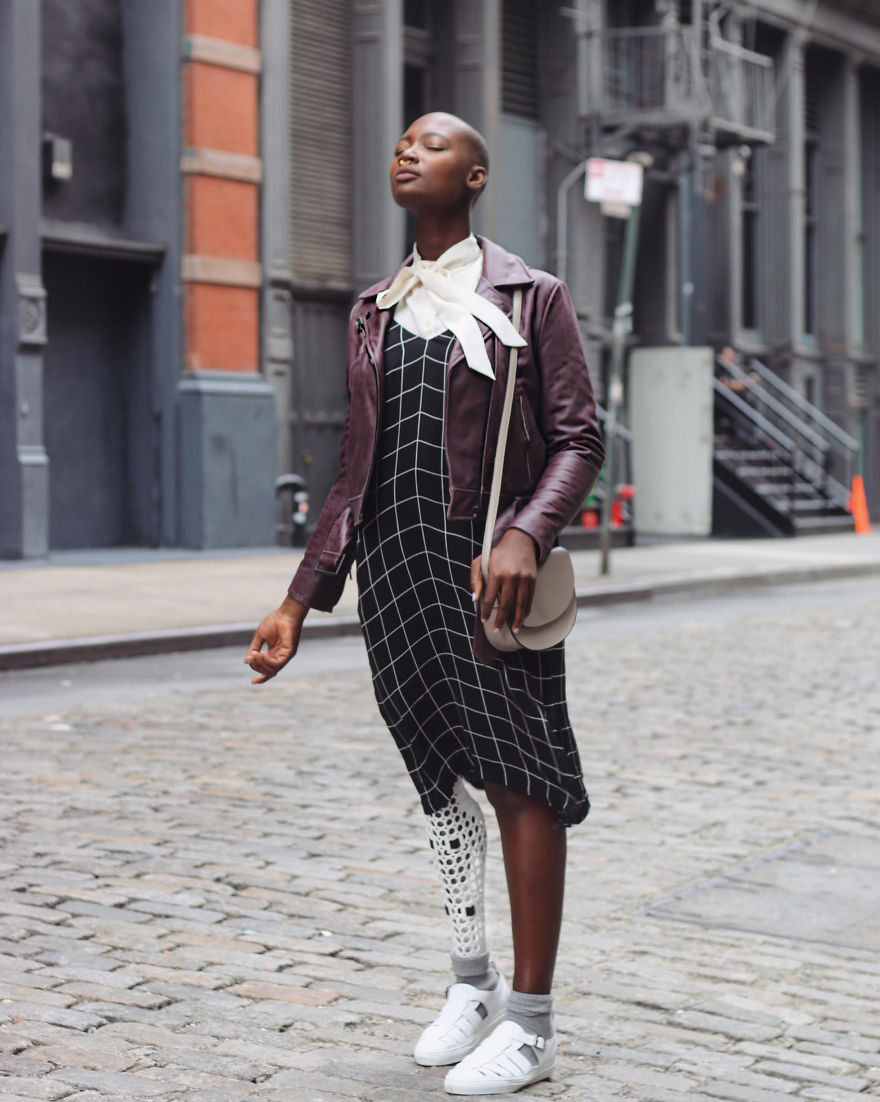 This Amazing Amputee Woman Will Inspire You To Feel Beautiful