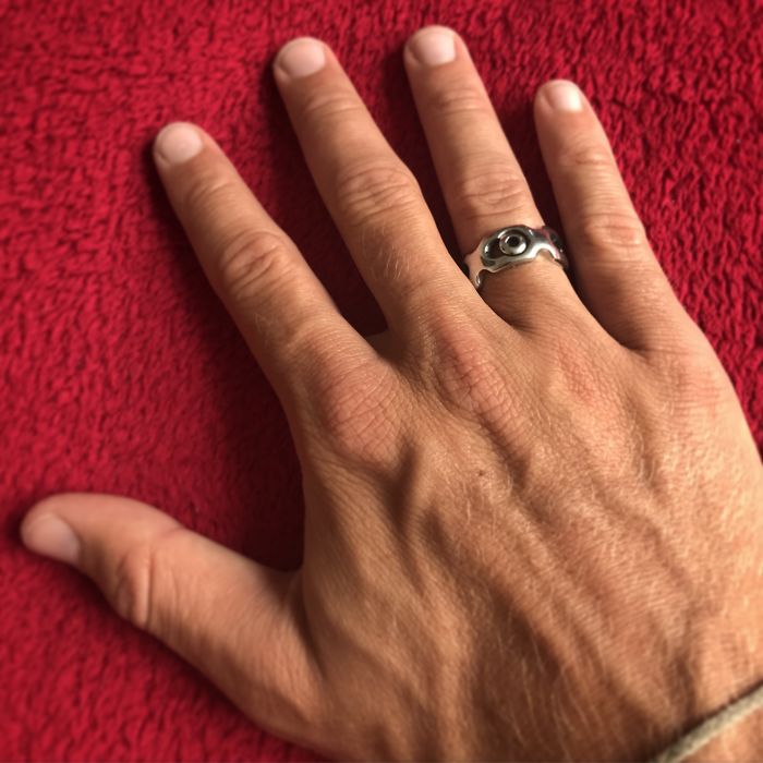 I Made A Ring Out Of The Metal Plate From My Surgery