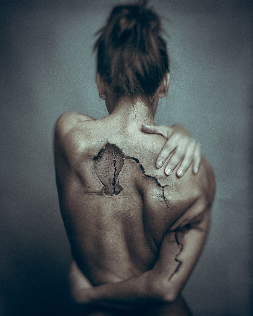 I Fracture People In Photoshop To Help Me Process My Own Medical Issues