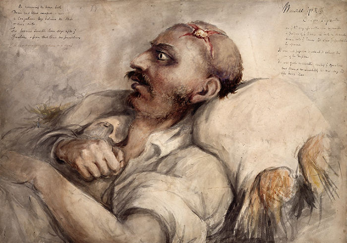 The Gruesome Artistic Talent Of Sir Charles Bell