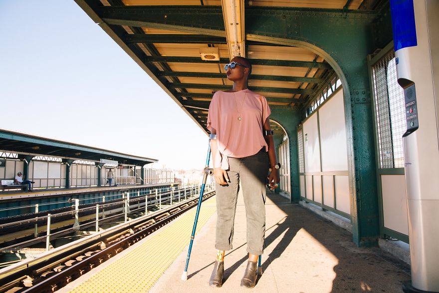 This Amazing Amputee Woman Will Inspire You To Feel Beautiful