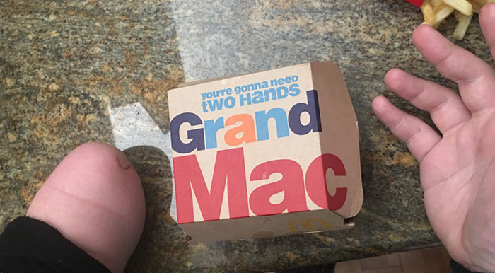 51 Hilarious Amputees Who Lost Their Limbs, But Not Their Sense Of Humor