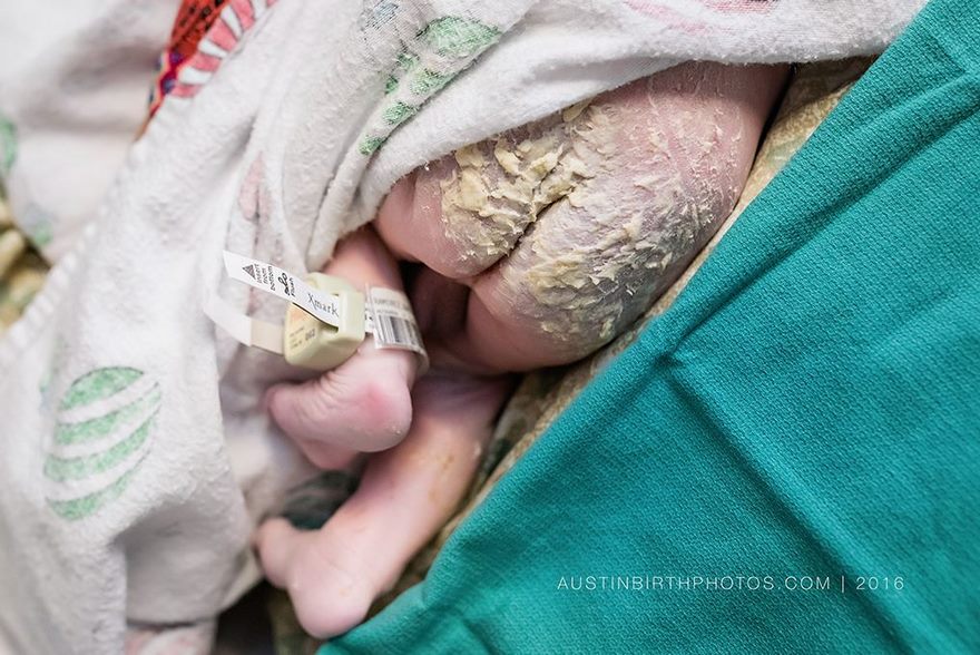 Baby's First Defense